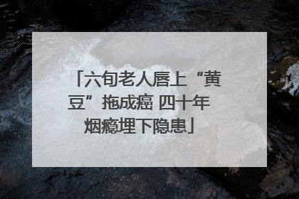 六旬老人唇上“黄豆”拖成癌 四十年烟瘾埋下隐患